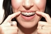 brackets_removibles6