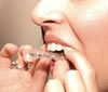 brackets_removibles7